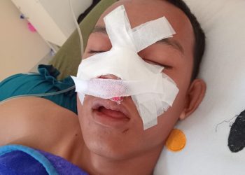 ‎Diduga Minim Pengawasan, Tahanan Mengalami Pemukulan di Dalam Rutan