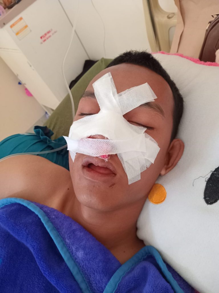 ‎Diduga Minim Pengawasan, Tahanan Mengalami Pemukulan di Dalam Rutan